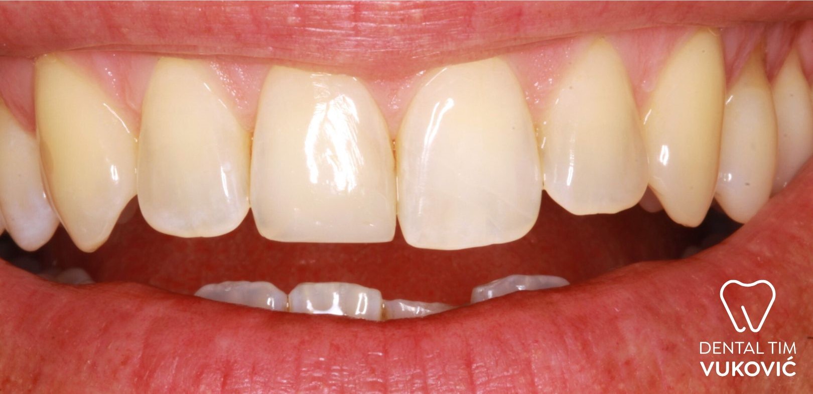 Poslije dentalnog rada