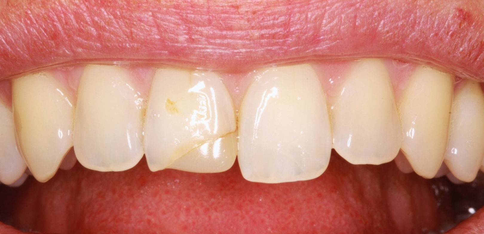 Prije dentalnog rada