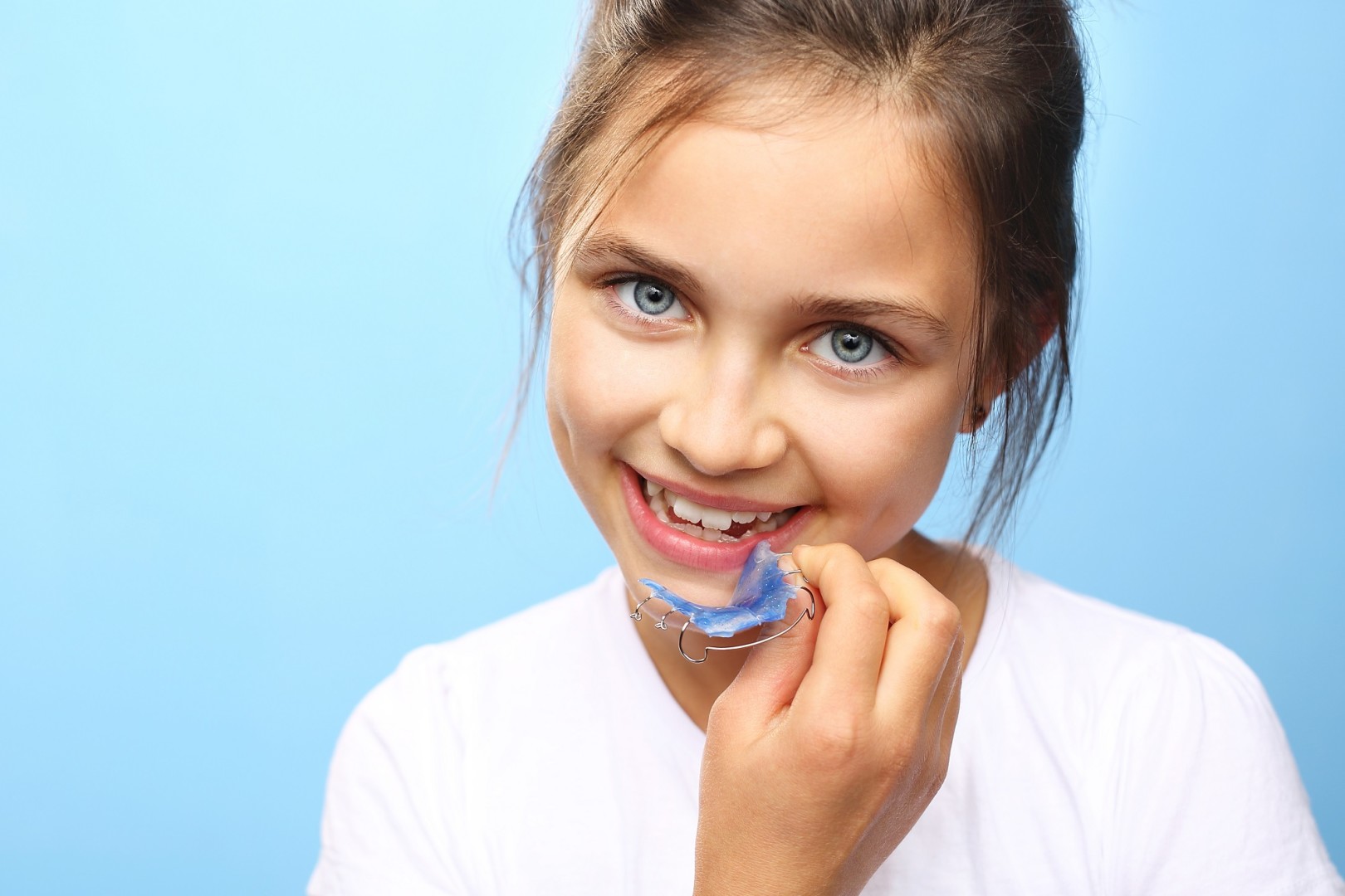 Ortodoncija u Dental Tim Vuković